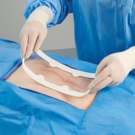 3M™ Tegaderm™ Absorbent Clear Acrylic Dressing