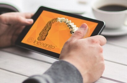 Incognito™ Appliance System Means Digital Workflow