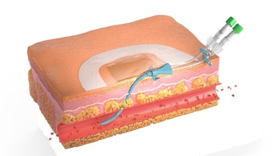 Med staff respiratory protection
