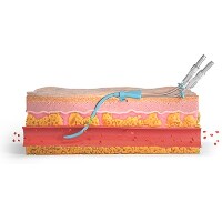 Vascular Access Solutions