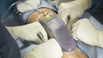 Image of patient at home with prevena dressing
