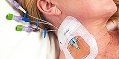 National Evidence-Based Guidelines for Preventing Healthcare-Associated Infections
