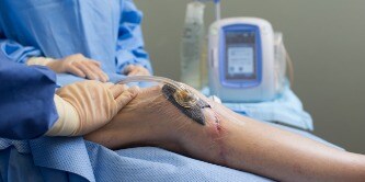 Veraflo Therapy on a knee with unit in background
