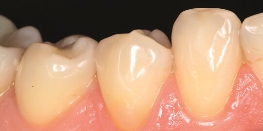 Clinical case supreme
